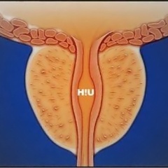 H!U